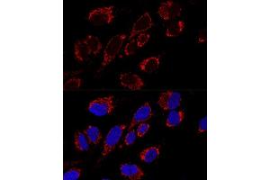 Confocal immunofluorescence analysis of U2OS cells using MRPS31 Polyclonal Antibody (ABIN6133059, ABIN6144045, ABIN6144046 and ABIN6216735) at dilution of 1:200.
