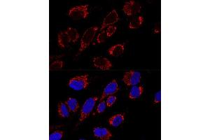 Confocal immunofluorescence analysis of U2OS cells using MRPS31 Polyclonal Antibody (ABIN6133059, ABIN6144045, ABIN6144046 and ABIN6216735) at dilution of 1:200. (MRPS31 anticorps  (AA 66-395))