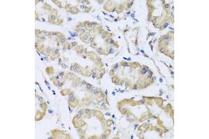 Immunohistochemistry of paraffin-embedded human stomach using RCN2 antibody (ABIN5975169) at dilution of 1/100 (40x lens). (RCN2 anticorps)