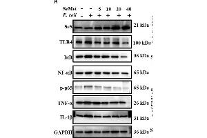 SeMet inhibited activation of TLR4/NF-κB pathway induced by ESBL-E.