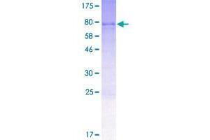 Image no. 1 for UFM1-Specific Ligase 1 (UFL1) (AA 1-509) protein (GST tag) (ABIN7540272)