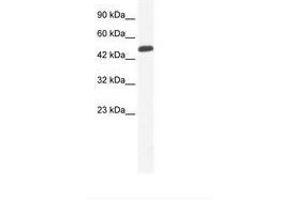 Image no. 1 for anti-Zinc Finger Protein 239 (ZNF239) (AA 41-90) antibody (ABIN6735993) (ZNF239 anticorps  (AA 41-90))