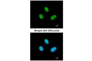 ICC/IF Image Immunofluorescence analysis of paraformaldehyde-fixed HeLa, using RPB2, antibody at 1:200 dilution.