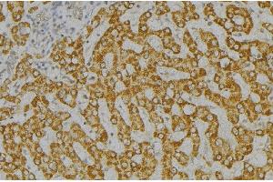 ABIN6276546 at 1/100 staining Mouse liver tissue by IHC-P. (SH2D1A anticorps  (Internal Region))