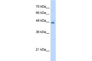 WB Suggested Anti-KYNU Antibody Titration:  5. (KYNU anticorps  (N-Term))