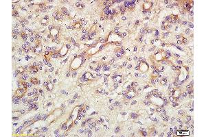 Formalin-fixed and paraffin embedded mouse tumor tissue labeled with Anti Endomucin Polyclonal Antibody, Unconjugated (ABIN1385912) at 1:200 followed by conjugation to the secondary antibody and DAB staining (Endomucin anticorps  (AA 21-120))
