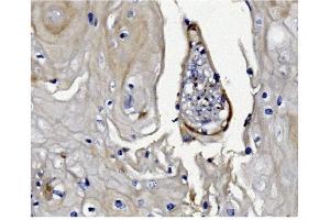 IHC analysis of GSDMD using anti-GSDMD antibody (ABIN7599432). (GSDMD anticorps  (AA 1-484))