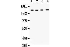Anti-MMP14 antibody, Western blotting All lanes: Anti MMP14  at 0.
