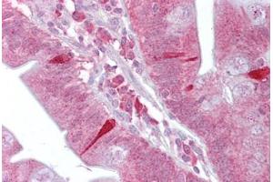 Anti-ATF4 antibody IHC staining of human small intestine.