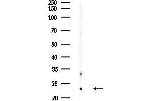 anti-BCL2-Related Ovarian Killer (BOK) (N-Term) antibody