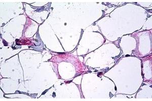 Human Breast, Collagen: Formalin-Fixed, Paraffin-Embedded (FFPE) (COL18A1 anticorps  (AA 801-850))