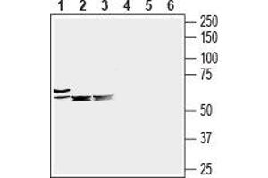 Western blot analysis of mouse heart (lanes 1 and 4), mouse brain (lanes 2 and 5) and rat brain (lanes 3 and 6) lysates: - 1-3. (SLC6A8 anticorps  (C-Term, Extracellular))