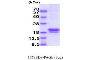 SDS-PAGE (SDS) image for CD160 (CD160) (AA 27-159) protein (His tag) (ABIN6388018)