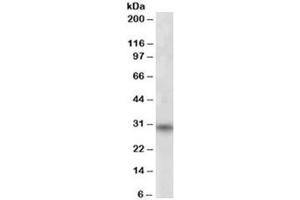 Western blot testing of human skeletal muscle lysate with FHL3 antibody at 1ug/ml.