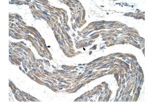 GPR161 antibody was used for immunohistochemistry at a concentration of 4-8 ug/ml to stain Skeletal muscle cells (arrows) in Human Muscle. (GPR161 anticorps  (C-Term))