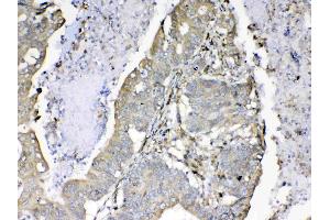 IHC analysis of Cyclophilin B using anti-Cyclophilin B antibody .