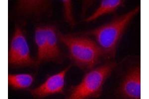 Immunofluorescence staining of methanol-fixed Hela cells using VASP(Ab-157) Antibody. (VASP anticorps)