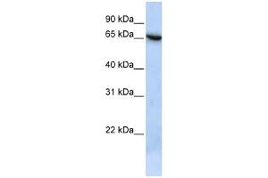 WB Suggested Anti-C19orf6 Antibody Titration: 0. (Membralin anticorps  (N-Term))