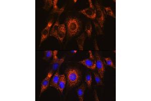 Immunofluorescence analysis of NIH/3T3 cells using UB Rabbit pAb (ABIN7271120) at dilution of 1:100. (UBAC2 anticorps  (AA 220-310))