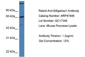 Western Blotting (WB) image for anti-ST6 (Alpha-N-Acetyl-Neuraminyl-2,3-beta-Galactosyl-1,3)-N-Acetylgalactosaminide alpha-2,6-Sialyltransferase 1 (ST6GALNAC1) (C-Term) antibody (ABIN785365) (ST6GALNAC1 anticorps  (C-Term))