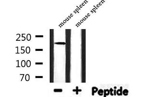 Western blot analysis of extracts from mouse spleen, using FANCM Antibody. (FANCM anticorps  (Internal Region))