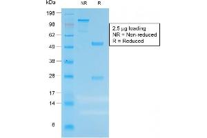 SDS-PAGE Analysis of Purified CEA Rabbit Recombinant Monoclonal Antibody (C66/1983R).