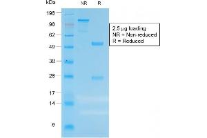 SDS-PAGE Analysis of Purified CEA Rabbit Recombinant Monoclonal Antibody (C66/1983R). (Recombinant CEACAM5 anticorps)