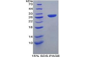 SDS-PAGE analysis of Mouse TRAF1 Protein. (TRAF1 Protéine)