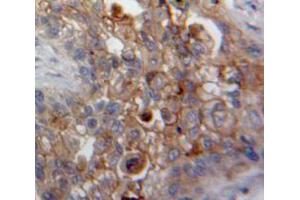 IHC-P analysis of Lung tissue, with DAB staining. (DDR2 anticorps  (AA 578-817))