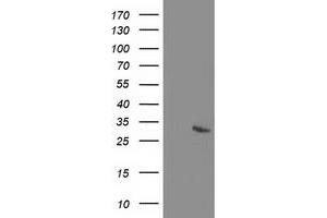 Western Blotting (WB) image for anti-Regulator of G-Protein Signaling 5 (RGS5) (AA 1-181) antibody (ABIN1490600) (RGS5 anticorps  (AA 1-181))