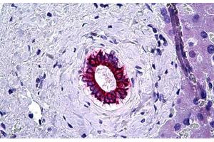 Human Liver, Bile Duct: Formalin-Fixed, Paraffin-Embedded (FFPE) (KRT8 anticorps)