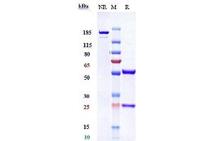 Anti-PDGFRB / CD140b Reference Antibody (IMC-2C5) on SDS-PAGE under reducing (R) condition.