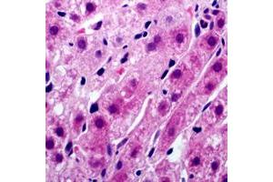 Immunohistochemical analysis of Tyrosinase staining in human liver formalin fixed paraffin embedded tissue section.