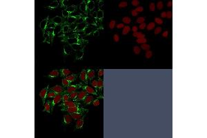Confocal Immunofluorescence image of HeLa cells stained with Clathrin, HC Monoclonal Antibody (CHC/1432) followed by Goat anti-Mouse CF488 (green). (Clathrin Heavy Chain (CLTC) anticorps)