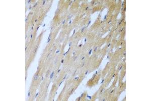 Immunohistochemistry of paraffin-embedded rat heart using ROCK1 antibody. (ROCK1 anticorps  (AA 400-660))