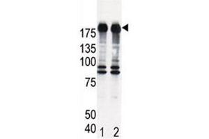 Western blot analysis of EGF Receptor antibody and HeLa cell lysate, either induced (Lane 1) or noninduced with EGF (2).