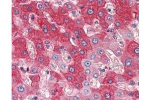 Immunohistochemical analysis of paraffin-embedded human liver tissues using FGFR4 mAb.