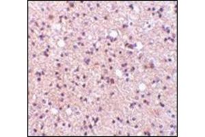 Immunohistochemistry of NPAS3 in human brain tissue with this product at 5 μg/ml. (NPAS3 anticorps  (Center))