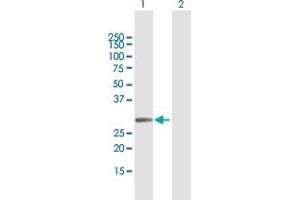 Western Blot analysis of MMS19 expression in transfected 293T cell line by MMS19 MaxPab polyclonal antibody. (MMS19 anticorps  (AA 1-293))
