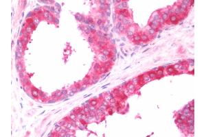 Anti-COL4A3BP / CERT antibody IHC staining of human prostate.