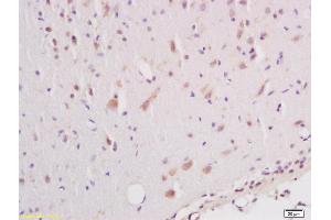 Formalin-fixed and paraffin embedded rat brain labeled with Anti phospho-B-Raf (Ser602) Polyclonal Antibody, Unconjugated (ABIN745373) at 1:200 followed by conjugation to the secondary antibody and DAB staining (SNRPE anticorps  (pSer602))