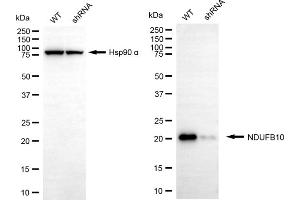 Western blotting analysis using NDUFB10 antibody (ABIN7799546).