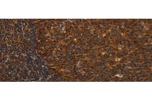 Immunohistochemistry of paraffin-embedded Human tonsil tissue using MIP Polyclonal Antibody at dilution 1:40 (Mip anticorps)