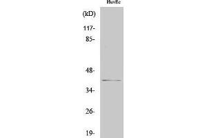 Western Blotting (WB) image for anti-Chloride Channel, Nucleotide-Sensitive, 1A (CLNS1A) (C-Term) antibody (ABIN3186440) (CLNS1A anticorps  (C-Term))