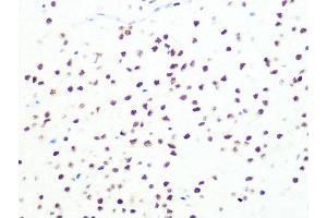 Immunohistochemistry of paraffin-embedded rat brain using DKC1 Rabbit mAb (ABIN7266869) at dilution of 1:100 (40x lens). (DKC1 anticorps)