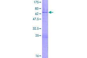 Image no. 1 for Zinc Finger Protein 444 (ZNF444) (AA 1-326) protein (GST tag) (ABIN1326201)