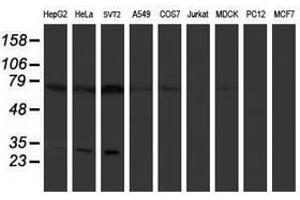 Image no. 1 for anti-Pallidin Homolog (PLDN) antibody (ABIN1500264) (Pallidin anticorps)