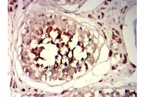 Immunohistochemical analysis of paraffin-embedded testis tissues using SP17 mouse mAb with DAB staining. (SPA17 anticorps  (AA 1-152))