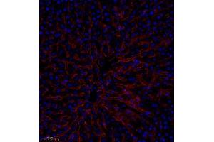Immunofluorescence analysis of paraffin embedded human liver using CD35 (ABIN7073563) at dilution of 1: 650 (CD35 anticorps)