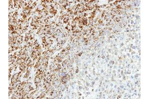 IHC-P Image Immunohistochemical analysis of paraffin-embedded SAS xenograft, using MTHFD2, antibody at 1:500 dilution.